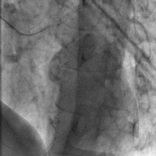 Cardiac and Interventional teaching files