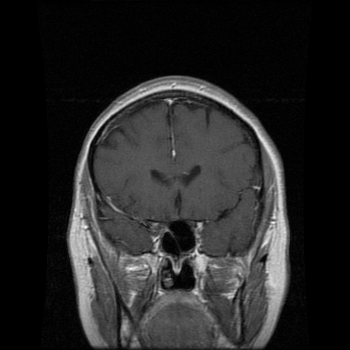 MRI Neuroradiology teaching files