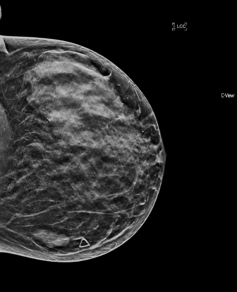 Mammography teaching files