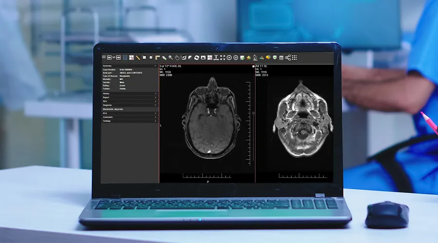 Radiology Teaching Files - Rosenfiled Health